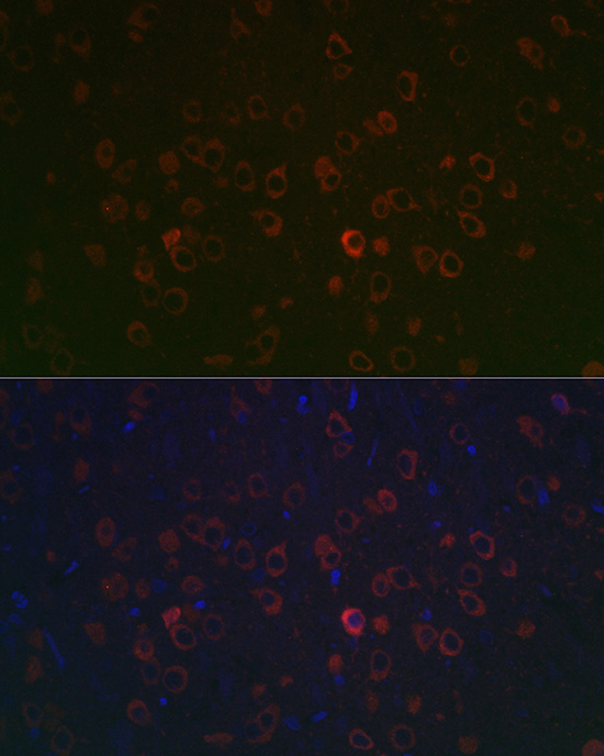 Immunofluorescence analysis of rat brain using REEP2 Polyclonal Antibody at dilution of 1:100 (40x lens). Blue: DAPI for nuclear staining.