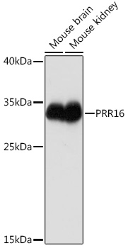 Western blot analysis of extracts of various cell lines using PRR16 Polyclonal Antibody at1:1000 dilution.