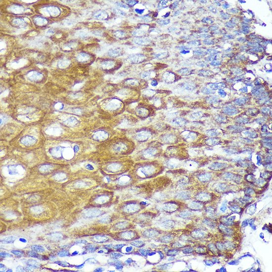 Immunohistochemistry of paraffin-embedded Human esophageal using CYB5R1 Polyclonal Antibody at dilution of 1:100 (40x lens).Perform microwave antigen retrieval with 10 mM PBS buffer pH 7.2 before commencing with IHC staining protocol.