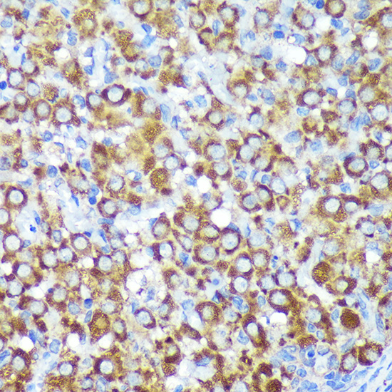 Immunohistochemistry of paraffin-embedded Rat ovary using CYB5R1 Polyclonal Antibody at dilution of 1:100 (40x lens).Perform microwave antigen retrieval with 10 mM PBS buffer pH 7.2 before commencing with IHC staining protocol.