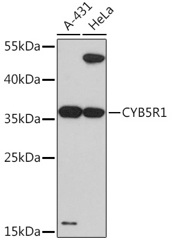 Western blot analysis of extracts of various cell lines using CYB5R1 Polyclonal Antibody at1:3000 dilution.