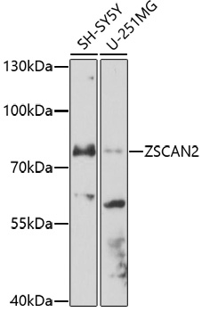 Western blot analysis of extracts of various cell lines using ZSCAN2 Polyclonal Antibody at 1:1000 dilution.