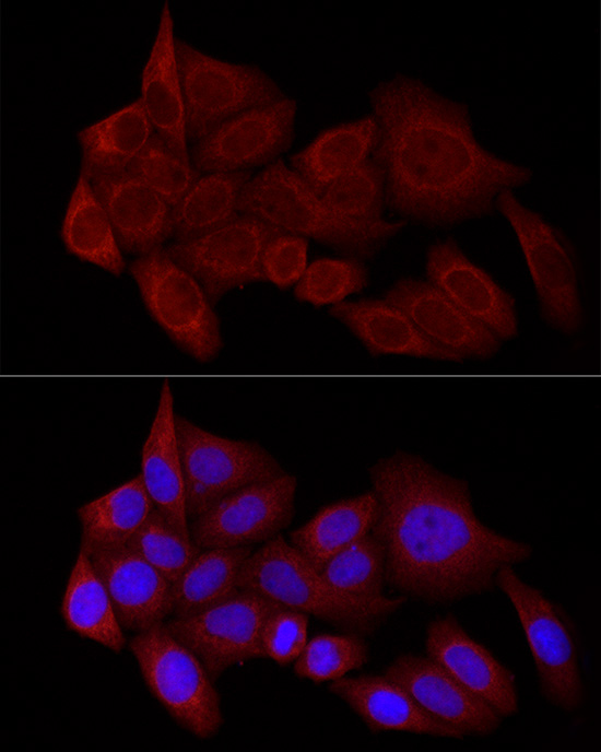 Immunofluorescence analysis of HeLa cells using STX17 Polyclonal Antibody at dilution of 1:100 (40x lens). Blue: DAPI for nuclear staining.