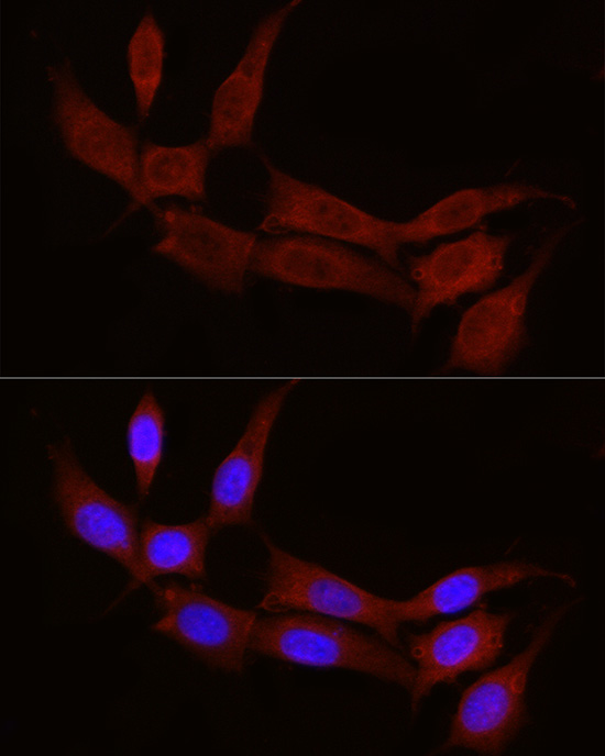 Immunofluorescence analysis of NIH/3T3 cells using STX17 Polyclonal Antibody at dilution of 1:100 (40x lens). Blue: DAPI for nuclear staining.