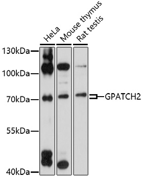 Western blot analysis of extracts of various cell lines using GPATCH2 Polyclonal Antibody at 1:1000 dilution.