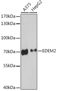 Western blot analysis of extracts of various cell lines using EDEM2 Polyclonal Antibody at1:3000 dilution.