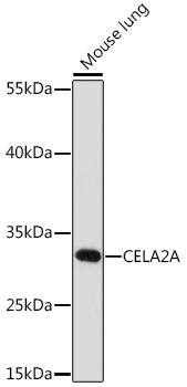 Western blot analysis of extracts of Mouse lung using CELA2A Polyclonal Antibody at1:1000 dilution.