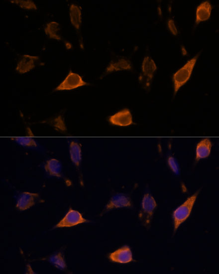 Immunofluorescence analysis of L929 cells using SEMA4A Polyclonal Antibody at dilution of 1:100. Blue: DAPI for nuclear staining.