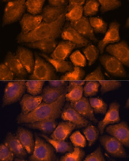 Immunofluorescence analysis of HeLa cells using NXN Polyclonal Antibody at dilution of 1:100. Blue: DAPI for nuclear staining.