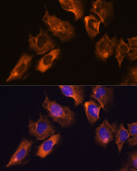 Immunofluorescence analysis of C6 cells using CAMKV Polyclonal Antibody at dilution of 1:100. Blue: DAPI for nuclear staining.