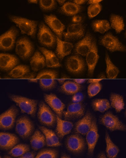 Immunofluorescence analysis of HeLa cells using CAMKV Polyclonal Antibody at dilution of 1:100. Blue: DAPI for nuclear staining.