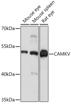 Western blot analysis of extracts of various cell lines using CAMKV Polyclonal Antibody at1:1000 dilution.