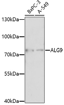 Western blot analysis of extracts of various cell lines using ALG9 Polyclonal Antibody at 1:1000 dilution.