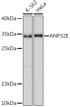 Western blot analysis of extracts of various cell lines using ANP32E Polyclonal Antibody at1:1000 dilution.