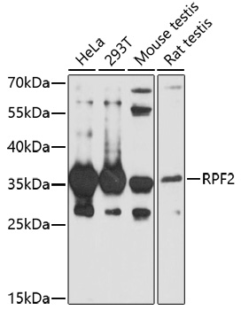 Western blot analysis of extracts of various cell lines using RPF2 Polyclonal Antibody at 1:1000 dilution.