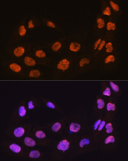 Immunofluorescence analysis of C6 cells using MAML2 Polyclonal Antibody at dilution of 1:100. Blue: DAPI for nuclear staining.