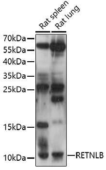 Western blot analysis of extracts of various cell lines using RETNLB Polyclonal Antibody at 1:1000 dilution.