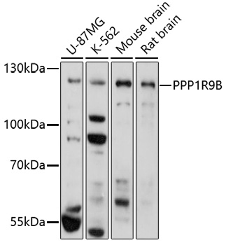 Western blot analysis of extracts of various cell lines using PPP1R9B Polyclonal Antibody at 1:1000 dilution.