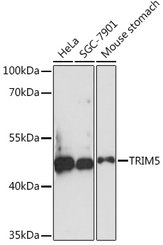 Western blot analysis of extracts of various cell lines using TRIM5 Polyclonal Antibody at1:1000 dilution.