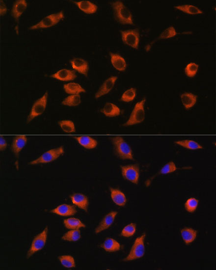 Immunofluorescence analysis of L929 cells using SYT12 Polyclonal Antibody at dilution of 1:100. Blue: DAPI for nuclear staining.