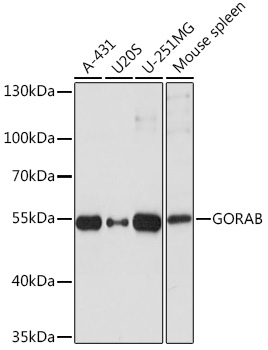 Western blot analysis of extracts of various cell lines using GORAB Polyclonal Antibody at1:1000 dilution.