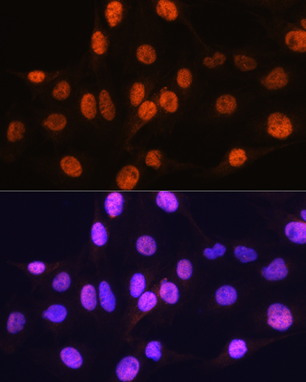 Immunofluorescence analysis of C6 cells using ARX Polyclonal Antibody at dilution of 1:100. Blue: DAPI for nuclear staining.