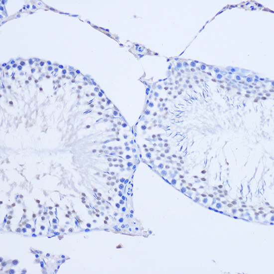 Immunohistochemistry of paraffin-embedded Rat testis using ARX Polyclonal Antibody at dilution of 1:50 (20x lens).Perform microwave antigen retrieval with 10 mM PBS buffer pH 7.2 before commencing with IHC staining protocol.