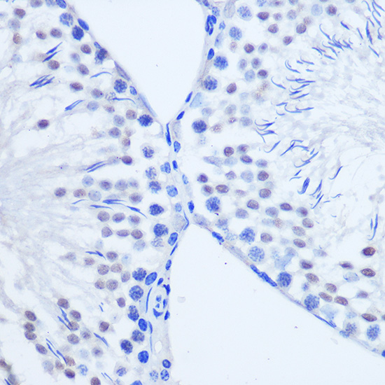 Immunohistochemistry of paraffin-embedded Rat testis using ARX Polyclonal Antibody at dilution of 1:50 (40x lens).Perform microwave antigen retrieval with 10 mM PBS buffer pH 7.2 before commencing with IHC staining protocol.