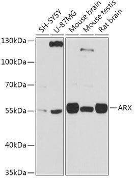 Western blot analysis of extracts of various cell lines using ARX Polyclonal Antibody at 1:1000 dilution.