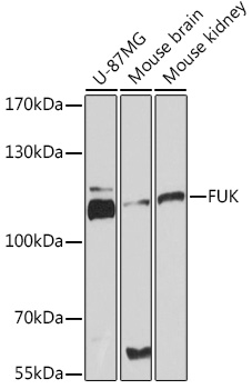 Western blot analysis of extracts of various cell lines using FUK Polyclonal Antibody at1:3000 dilution.