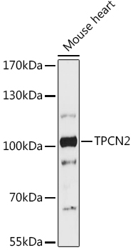 Western blot analysis of extracts of Mouse heart using TPCN2 Polyclonal Antibody at 1:1000 dilution.