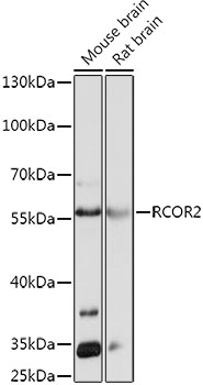 Western blot analysis of extracts of various cell lines using RCOR2 Polyclonal Antibody at 1:1000 dilution.