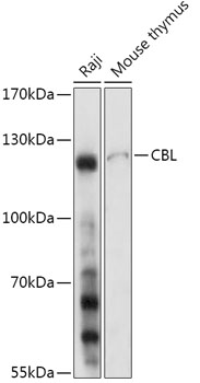 Western blot analysis of extracts of various cell lines using CBL Polyclonal Antibody at 1:1000 dilution.