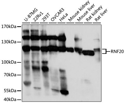 Western blot analysis of extracts of various cell lines using RNF20 Polyclonal Antibody at 1:1000 dilution.