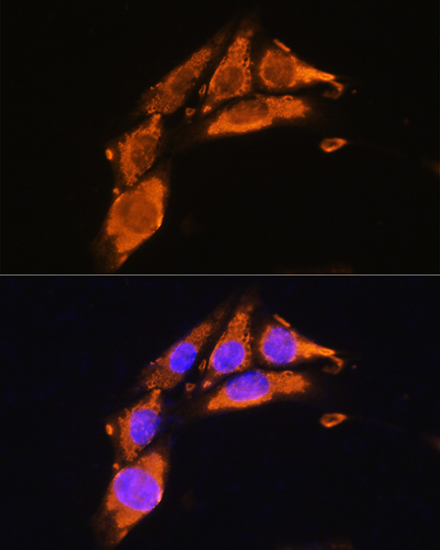 Immunofluorescence analysis of NIH/3T3 cells using AGRN Polyclonal Antibody at dilution of 1:100. Blue: DAPI for nuclear staining.