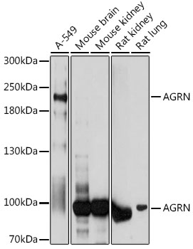 Western blot analysis of extracts of various cell lines using AGRN Polyclonal Antibody at 1:1000 dilution.