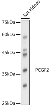 Western blot analysis of extracts of Rat kidney using PCGF2 Polyclonal Antibody at 1:1000 dilution.