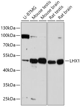 Western blot analysis of extracts of various cell lines using LHX1 Polyclonal Antibody at 1:1000 dilution.