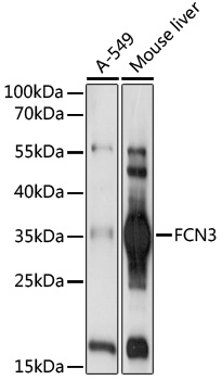 Western blot analysis of extracts of various cell lines using FCN3 Polyclonal Antibody at 1:1000 dilution.