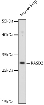 Western blot analysis of extracts of Mouse lung using RASD2 Polyclonal Antibody at 1:1000 dilution.