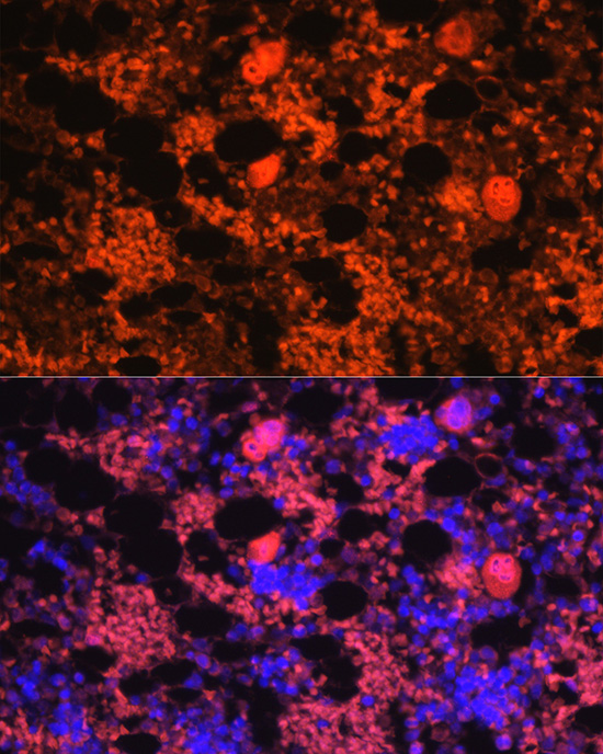 Immunofluorescence analysis of rat bone marrow using CXCL4/PF4 Polyclonal Antibody at dilution of 1:100 (40x lens). Blue: DAPI for nuclear staining.