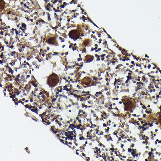 Immunohistochemistry of paraffin-embedded rat bone marrow using CXCL4/PF4 Polyclonal Antibody at dilution of 1:50 (40x lens).Perform high pressure antigen retrieval with 10 mM citrate buffer pH 6.0 before commencing with IHC staining protocol.