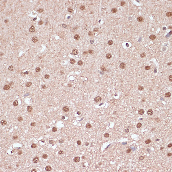 Immunohistochemistry of paraffin-embedded rat brain using ITCH Polyclonal Antibody at dilution of 1:100 (40x lens).Perform microwave antigen retrieval with 10 mM PBS buffer pH 7.2 before commencing with IHC staining protocol.