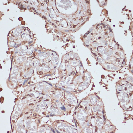 Immunohistochemistry of paraffin-embedded human placenta using ITCH Polyclonal Antibody at dilution of 1:100 (40x lens).Perform microwave antigen retrieval with 10 mM PBS buffer pH 7.2 before commencing with IHC staining protocol.