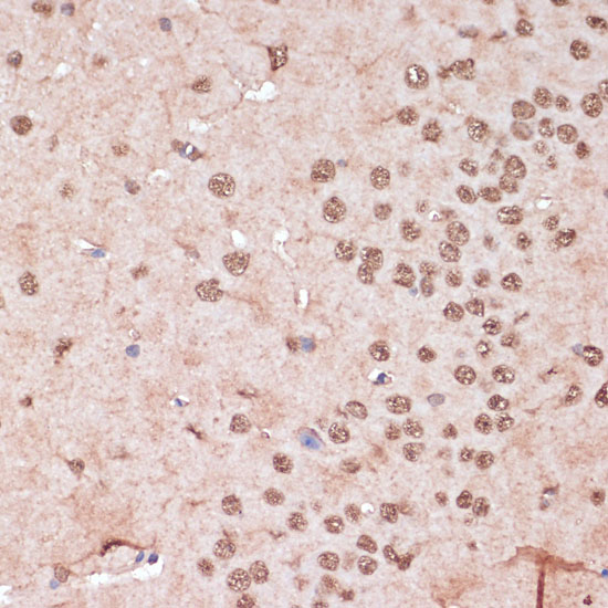 Immunohistochemistry of paraffin-embedded mouse brain using ITCH Polyclonal Antibody at dilution of 1:100 (40x lens).Perform microwave antigen retrieval with 10 mM PBS buffer pH 7.2 before commencing with IHC staining protocol.