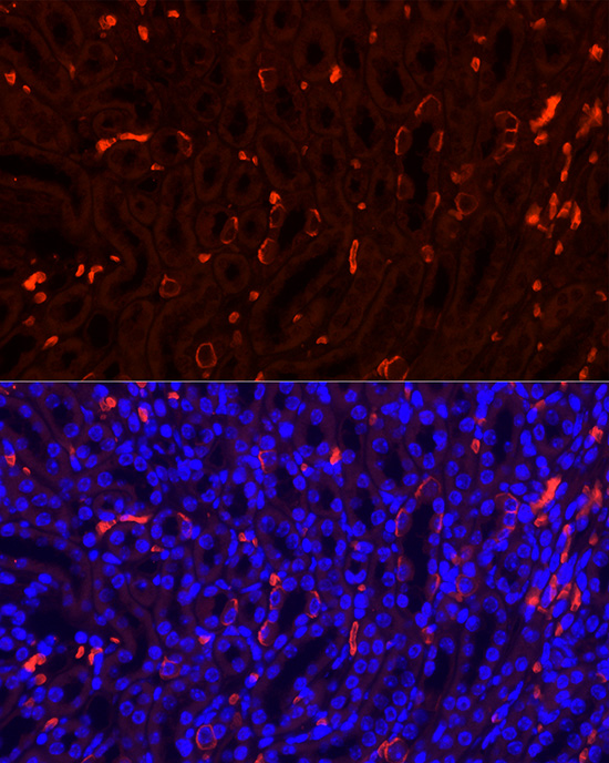 Immunofluorescence analysis of Mouse kidney using SLC4A1 Polyclonal Antibody at dilution of 1:100. Blue: DAPI for nuclear staining.