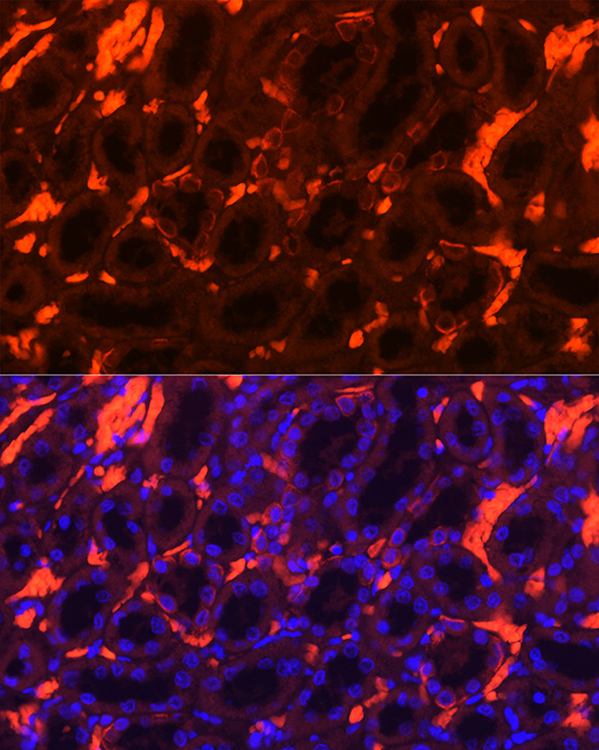 Immunofluorescence analysis of Rat kidney using SLC4A1 Polyclonal Antibody at dilution of 1:100. Blue: DAPI for nuclear staining.