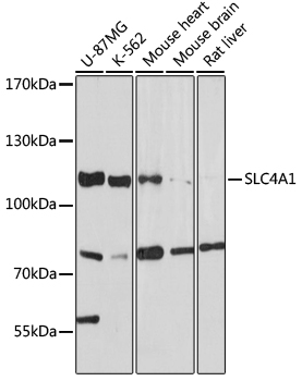 Western blot analysis of extracts of various cell lines using SLC4A1 Polyclonal Antibody at 1:1000 dilution.