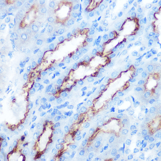 Immunohistochemistry of paraffin-embedded Mouse kidney using PDGFA Polyclonal Antibody at dilution of 1:100 (40x lens).Perform microwave antigen retrieval with 10 mM Tris/EDTA buffer pH 9.0 before commencing with IHC staining protocol.