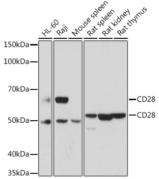 Western blot analysis of extracts of various cell lines using CD28 Polyclonal Antibody at 1:1000 dilution.